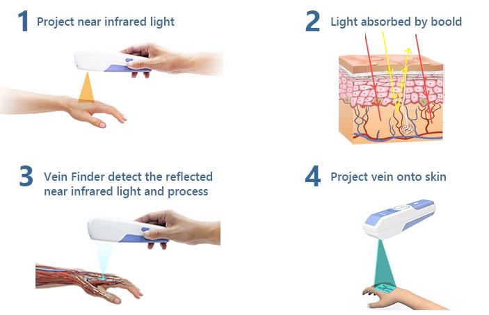 VeinSight/vein finder/vein ligth/vein inlluminator